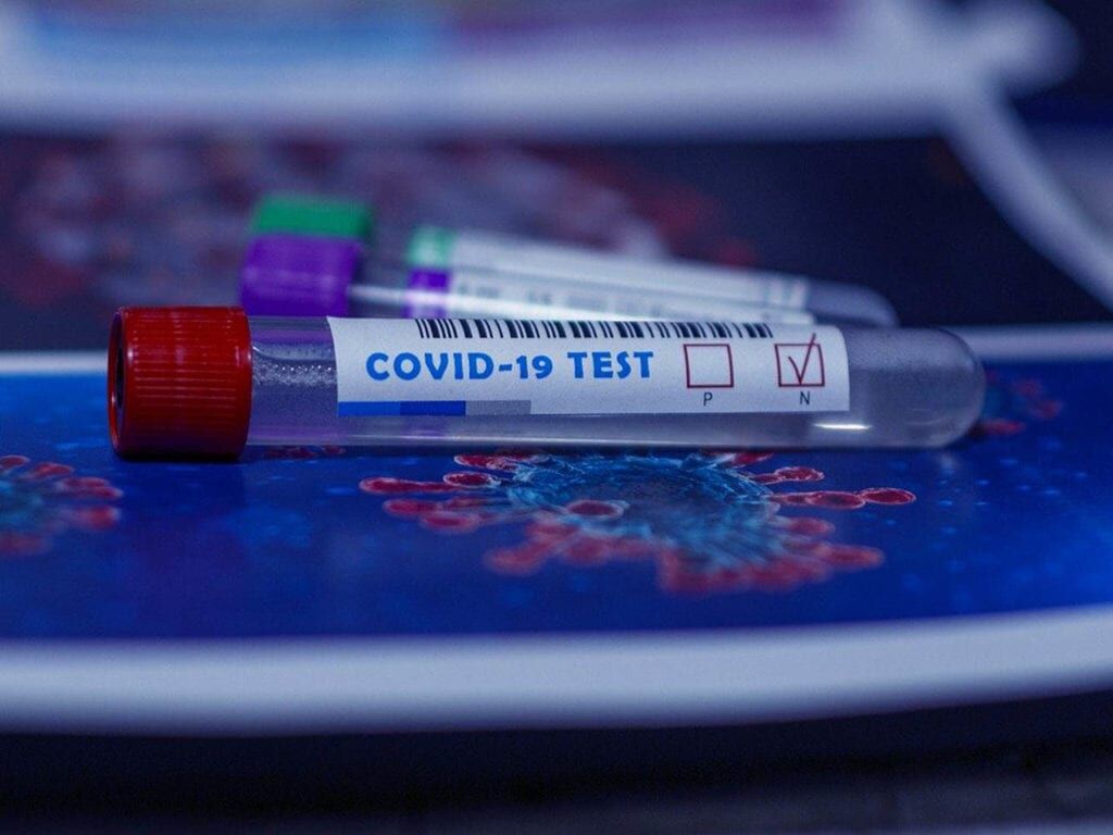 covid 19 test